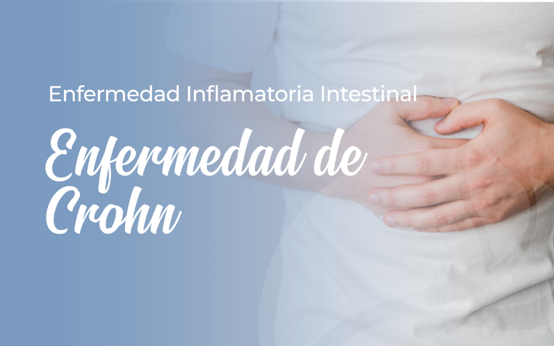 Enfermedad Inflamatoria Intestinal: Enfermedad de Crohn