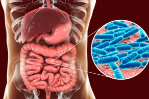 Sobrecrecimiento bacteriano, intestino delgado, enfermedades gastrointestinales, expertos en salud digestiva